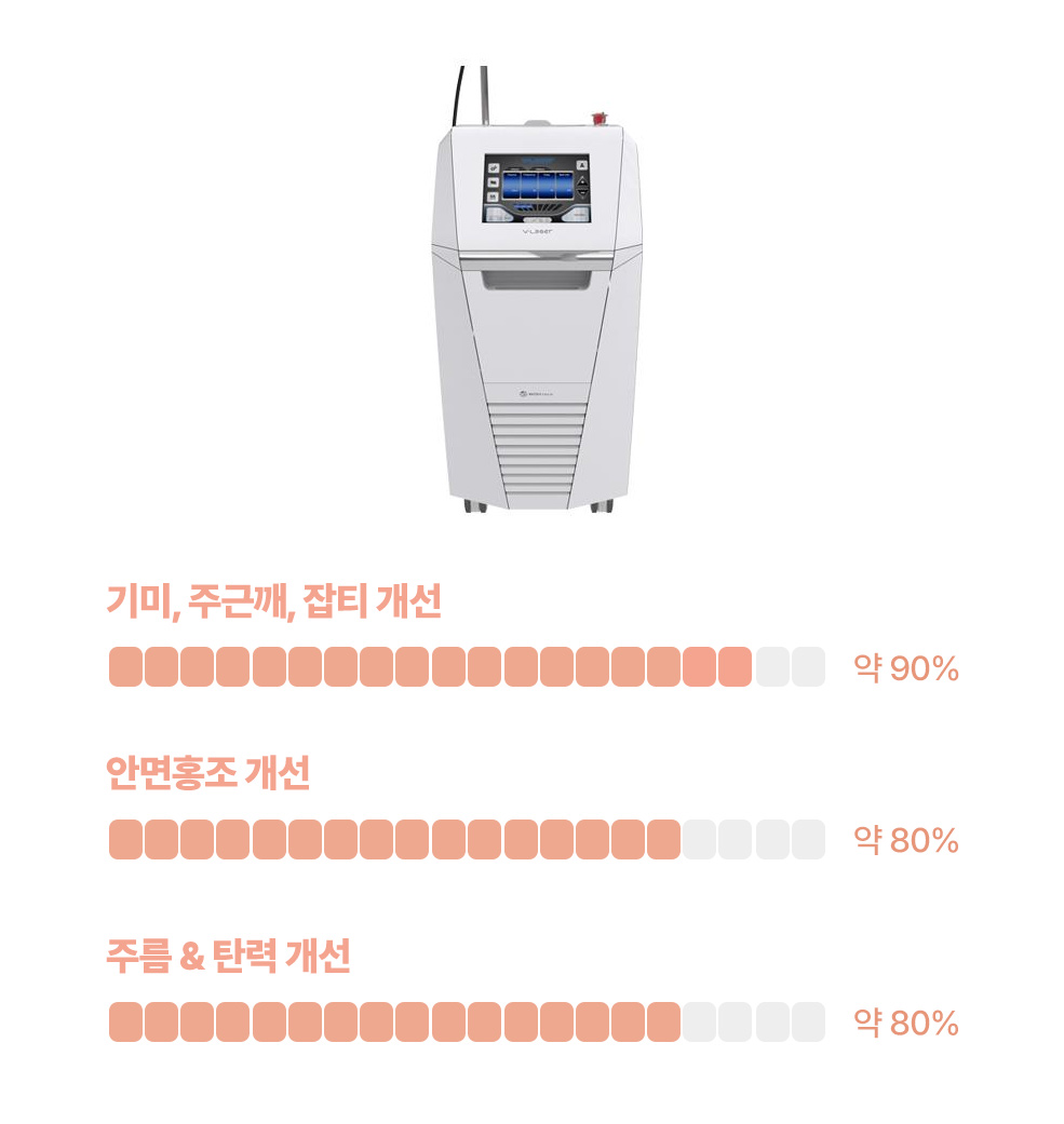 V레이저 효과