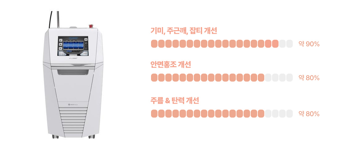 V레이저 효과